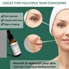 BIOCHEM Nonapeptide-1 Brightening Serum–Dark Spot Corrector & Melanin Inhibitor Ampoule