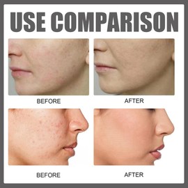 Deep Serum Rice + Alpha-Arbutin,Face Serum,Serum with Rice Extract and Niacinamide Moisturiser Face,Hyaluronic Acid Face Serums,Anti Wrinkle Serum,Brightening Serum,Anti Aging Serum For Face