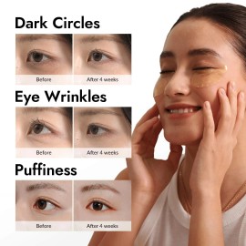 MIZON Under Eye Patches for Puffy Eyes & Dark Circles, 24K Gold & Snail...