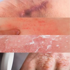 Pomada Magica Crema Reparadora Arnica Y Calendula Stanhome