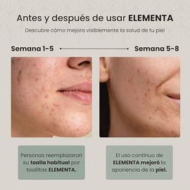 Elementa Toallas Faciales Secas Extra Grandes Desechables (Rostro Limpio y Sin Bacterias), Hipoalergénicas, 100% Biodegradables | Toallitas Desmaquill