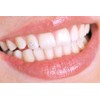 Tooth Jewellery - Professional Set with Tooth Jewels - Tooth