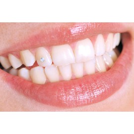 Tooth Jewellery - Professional Set with Tooth Jewels - Tooth Crystal Ornaments Decoration