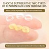 Ingrown Toenails Set, Nail Clip, Toenails, Pack of 180