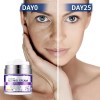 Crema Rejuvenece Antiedad Retinol 2.5% Aloe Vera Antiarrugas
