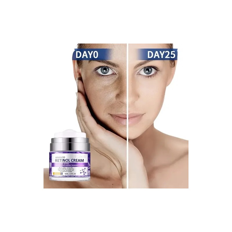 Crema Rejuvenece Antiedad Retinol 2.5% Aloe Vera Antiarrugas