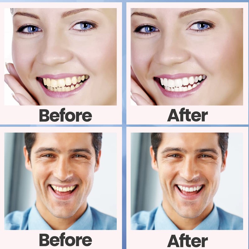 Teeth Whitening Strips (28PCS)