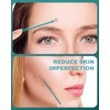 BEZOX Blackhead Remover Tool Kit - Pore Extractor Tools for