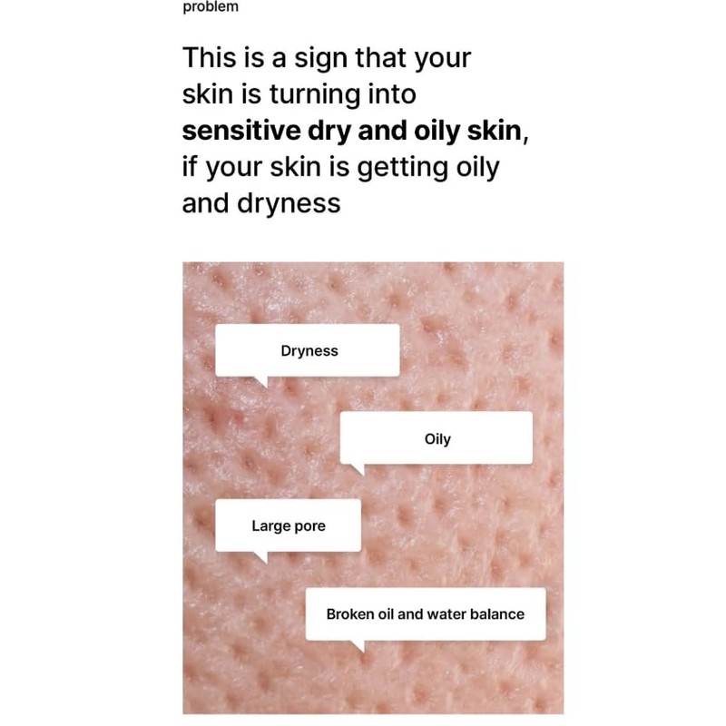 celimax - OIL CONTROL MOISTURIZING CREAM