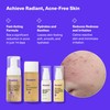 Dermz Acne Treatment - Acne Cream, SPF Face Protection, Face