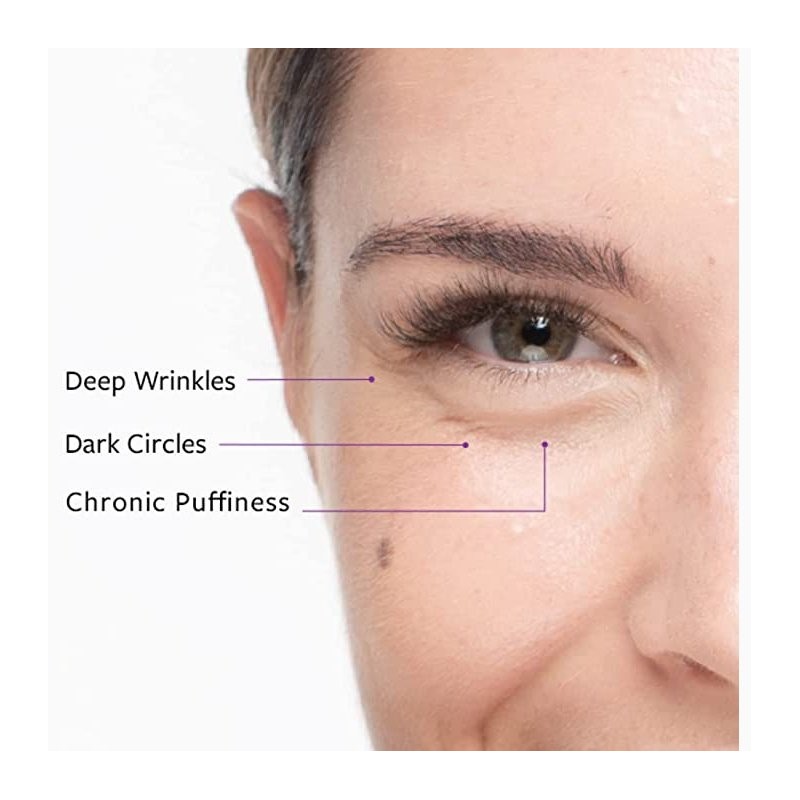 Freezeframe Revitaleyes 15mL