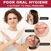 SP-6 Probiotics Whitening Toothpaste, with Probiotics Deep Cleaning Oral Care
