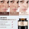 Crema Despigmentante De Manchas Paño Melasma Pecas Blanquea