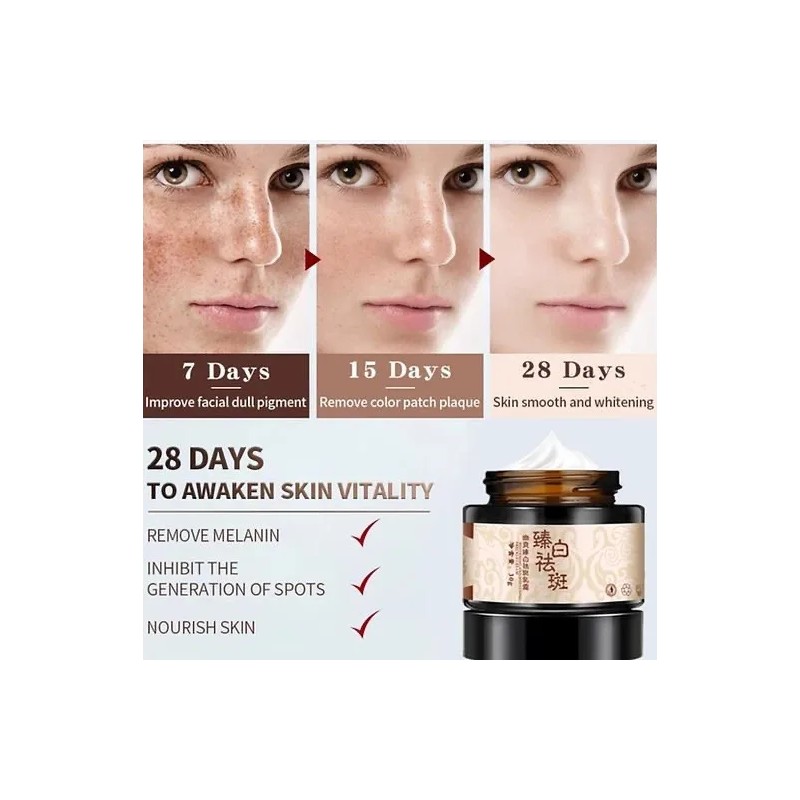 Crema Despigmentante De Manchas Paño Melasma Pecas Blanquea