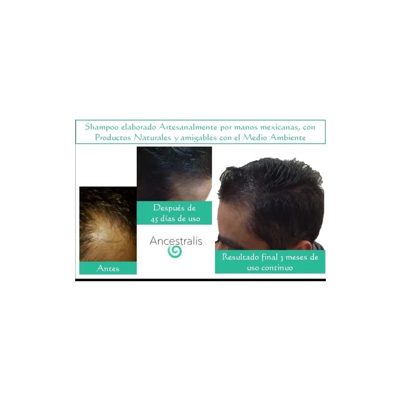 Shampo Anticaída Cabello Ancestralis