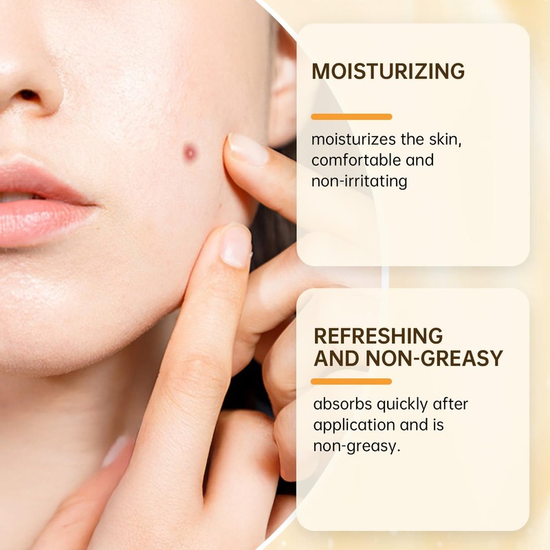 FIYADWZH Fast-Acting Bee Venom Cream,Natural Bee Venom Cream,Face Cream Moisturiser,for