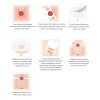 Bolsas Para Colostomia Osto System Adulto 10 Piezas