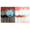 Approximately 2 months supply of oral lactic acid bacteria /