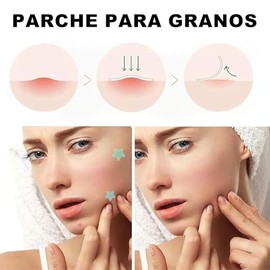 Parches para Acné, 316 Parche Maestro para el Acné, Parches de Estrellas, Hidrocoloides, Reduce Visiblemente Las Immperfecciones Granos y Espinillas, 