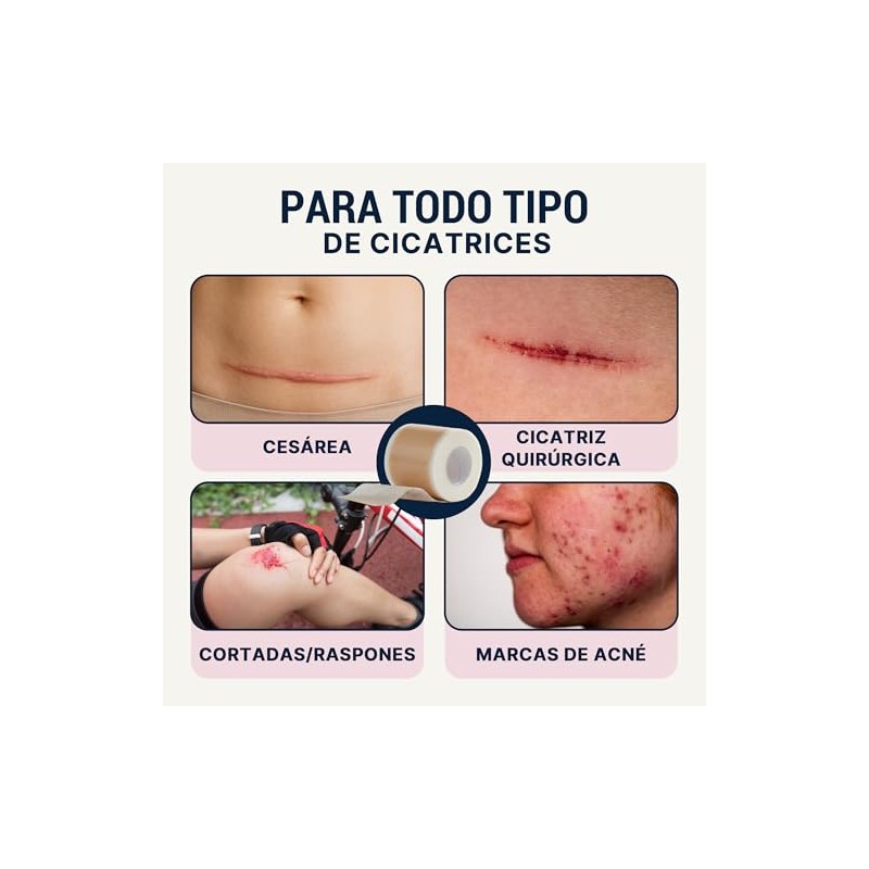 Over Lu DermaSilk™ | Cinta de Silicona para Cicatrices –