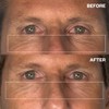 Wrinkles Schminkles Men's Pro Eye Wrinkle Patches - 3 Pairs