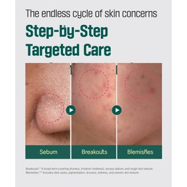 ROUND LAB Pine Cica Calming Cream Plus 60ml – Dual-Texture Soothing Cream for Blemish Care, Acne-Prone Skin Safe, Sebum & Oil Control, Intensive Calming, Strengthens Skin Barrier, Clear & Calm Finish