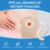 Pack of 20 Ostomy Barrier Ring Leak Skin Barrier Fixing