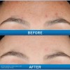2 Cerave Serums Retinol Rejuvenecimiento Para Piel