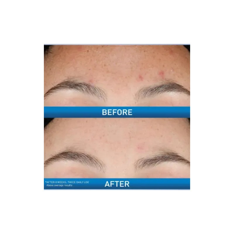 2 Cerave Serums Retinol Rejuvenecimiento Para Piel