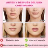 2pz Faja Mentonera Reduce Arruga Papada Y Adelgazante Facial