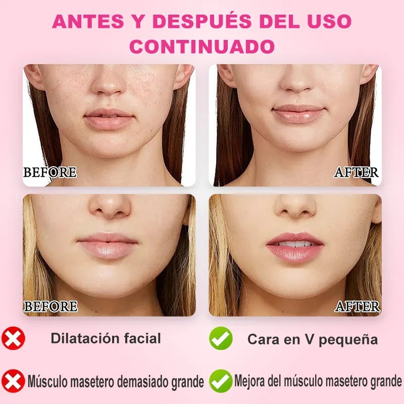 2pz Faja Mentonera Reduce Arruga Papada Y Adelgazante Facial