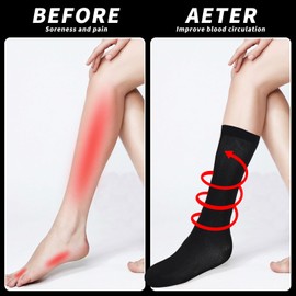 Compression Socks for Women 2pairs Surgical Compression Socks Flight Socks for Men Knee High Knee High Varicose Veins Socks Stockings for Sport Running Travel Nursing Pregnancy 20-25 mmhg…
