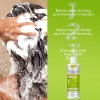 Shampoo Antifúngico Cuero Cabelludo Sensible 200 Ml