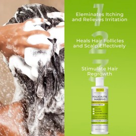 Shampoo Antifúngico Cuero Cabelludo Sensible 200 Ml