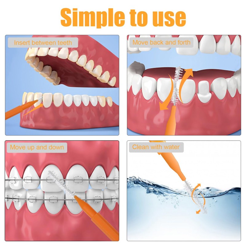 ULTECHNOVO 100piezas Cepillos Interdentales Para Limpieza De Brackets Herramienta De