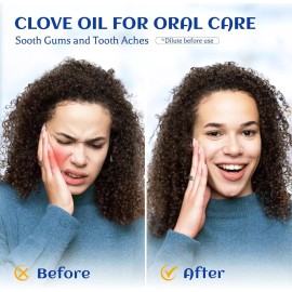 Clove Oil Aceite Esencial De Clavo De Olor 100% Puro Y Natural Sin Diluir Terapeutico ys