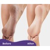 6 Packs Foot Pumice Stone, Double Sided Foot Scrub for