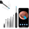 Ear Wax Removal, Ear Wax Removal Tool Camera Built-in 1080P HD Otoscope Camera, with 8 Pcs Ear Set, Easy and Safe Ear Cleaning, for iPhone, iPad & Android, Ear Cleaner Earwax Removal Kit (Black-New)