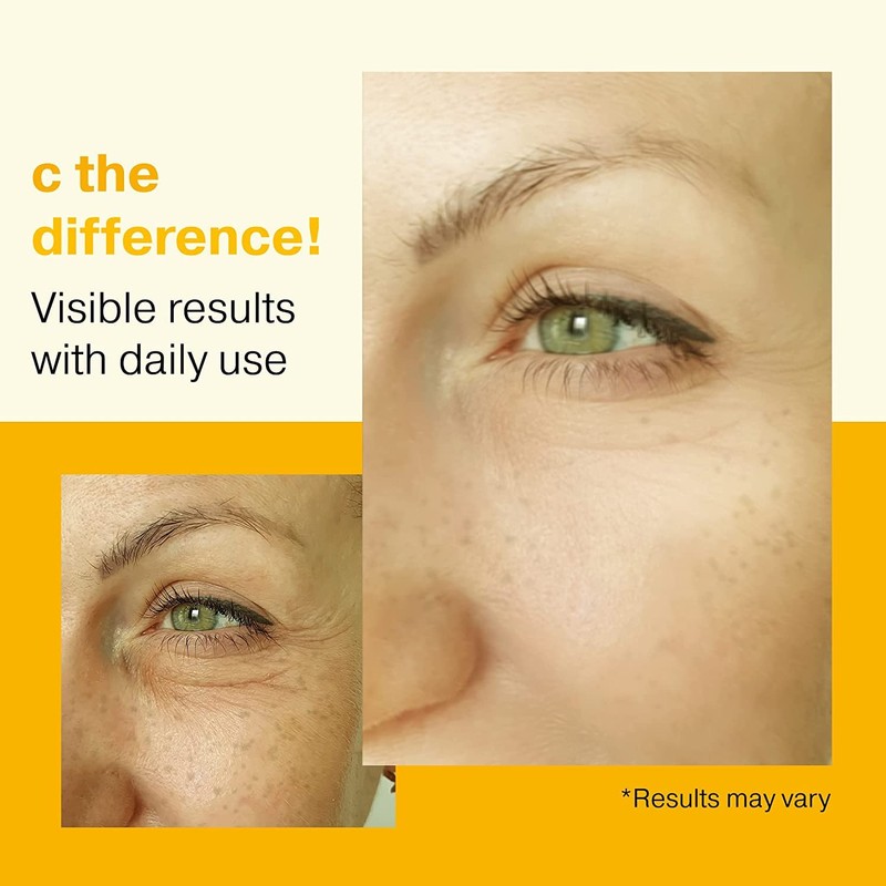 Vitamin C Concentrate Serum, For Aged Skin, Vitamin C Serum,