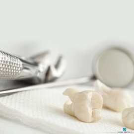 DEXA DENTAL Heavy Duty Dental Extracting Forceps # 150 Apical Forcep