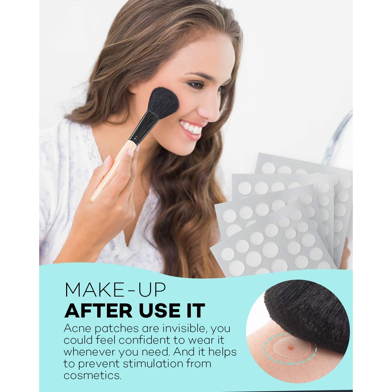 TKTK Pimple Patch Acne Patch, 4 Sizes 280 Patches Acne