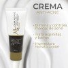 Crema Anti Acné Mc Life Control De Grasa Reduce Manchas