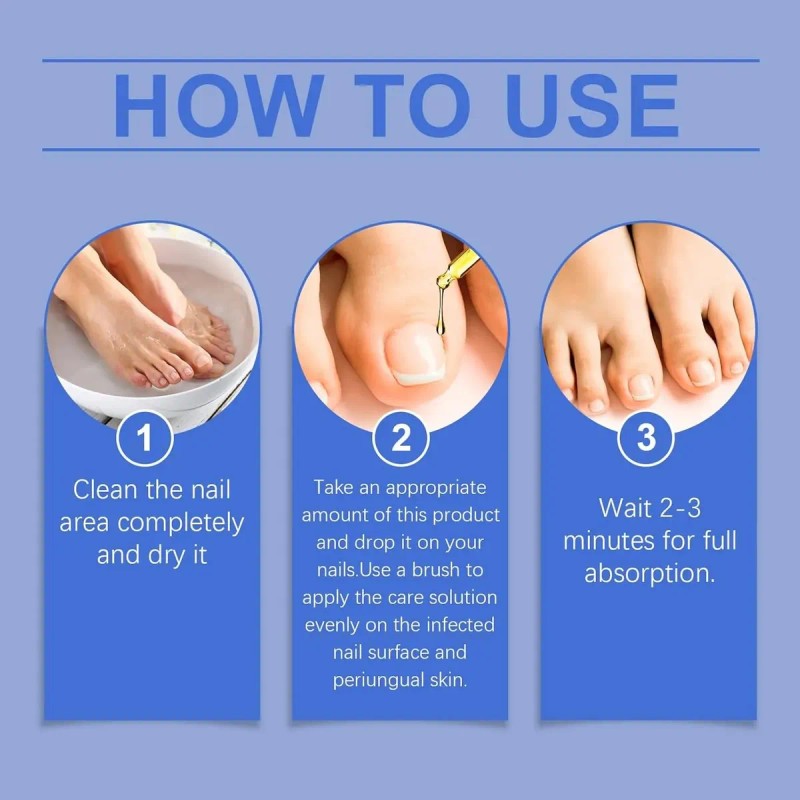 Tratamiento De Uñas De Los Pies Para Mujeres, Extractos De