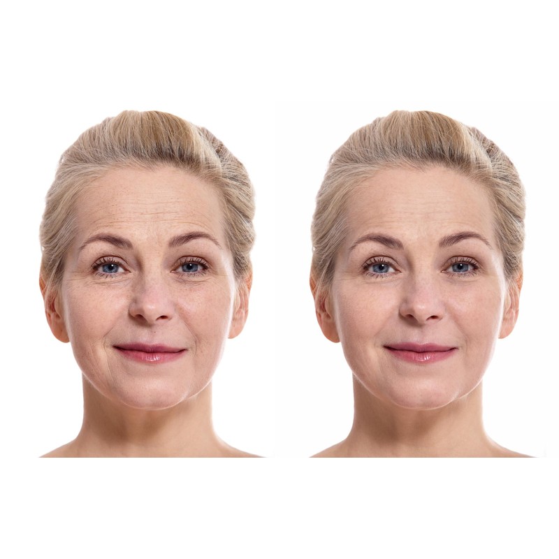 Vitality Precision Skin Micro-Exfoliating Scrub