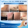 UPF50+ Silicone Scar Sheets with UV Protection(1.8”x 157" Roll 4M)
