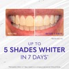 Smileactives Teeth Whitening Gel for Toothpaste with Clinical-Grade Hydrogen Peroxide,