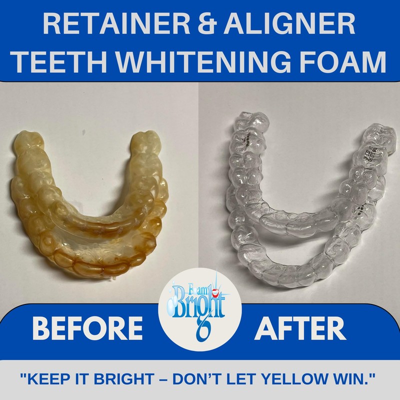 Retainer Cleaner & Aligner Cleaner FoamBright, Great for Invisalign, Teeth