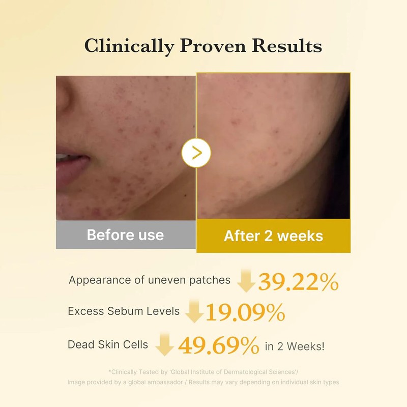 Medicube Kojic Acid Turmeric Pad - 70 Pieces