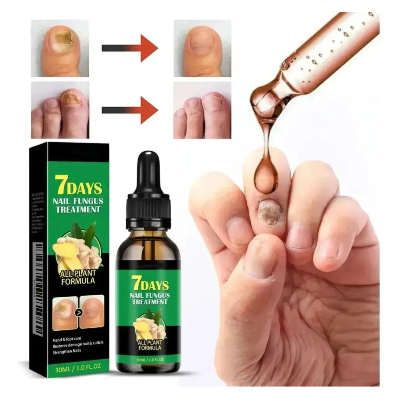 Sérum Jaysuing 7 Days Aceite Uñas Fuertes Jengibre 30ml