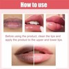 Fast Lightening Pink Mouth Lips Serum Bleaching Permanent Remove Dark